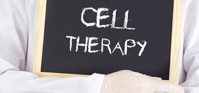 Resultados parciais do estudo clínico em pacientes com ELA usando a terapia celular AstroRx®